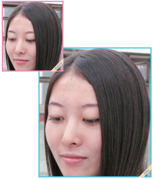 使用Photoshop CS6去除自拍照脸上的小痘痘