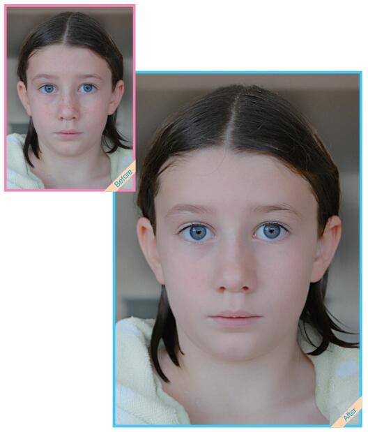 脸上有大块小块面积的雀斑可以用Photoshop快速清除