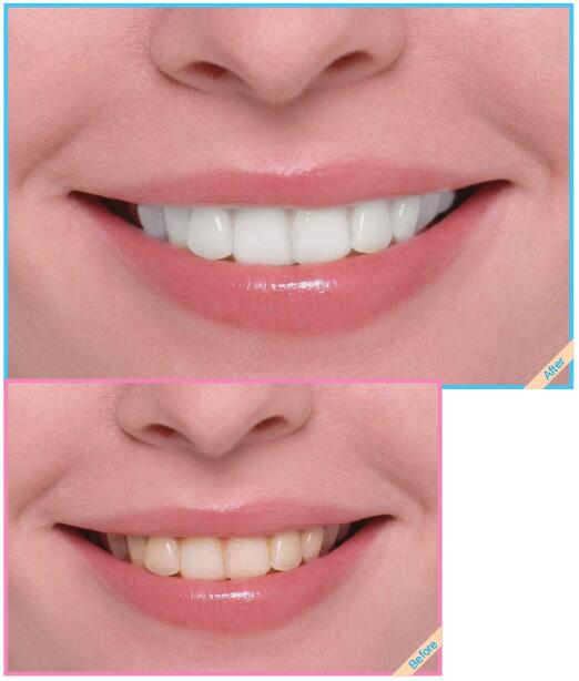 照片牙齿好黄用Photoshop能使把牙齿变白吗？