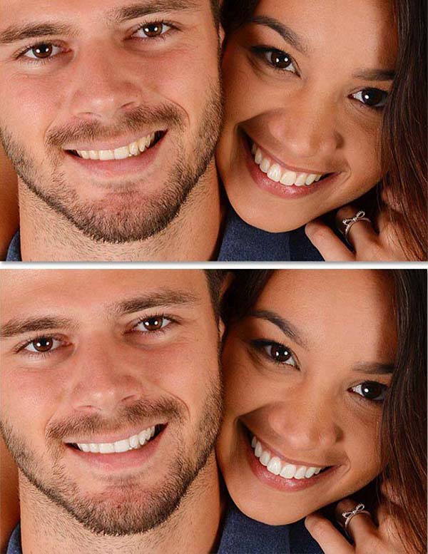 ps怎么美白牙齿? ps给图片美白牙齿的教程